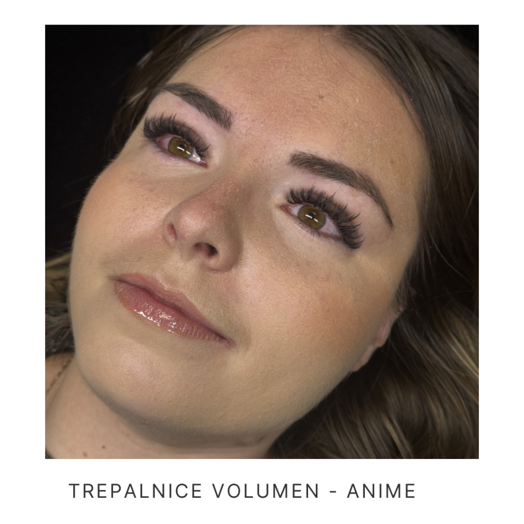 trepalnice kranj
