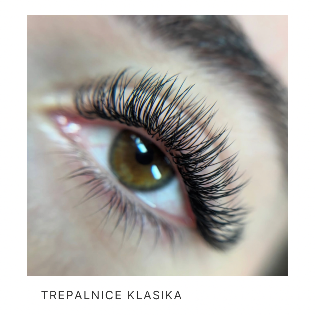 wispy trepalnice