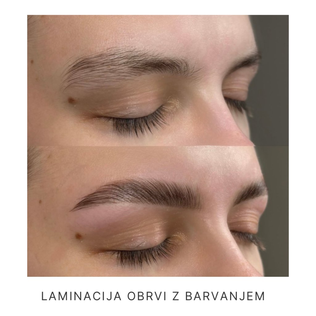 laminacija obrvi